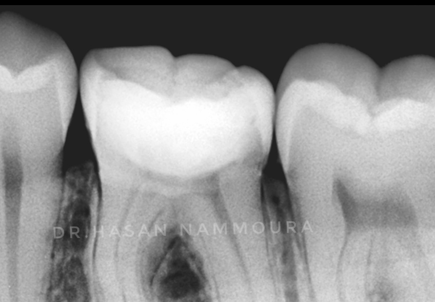 inbound1781726254275335275