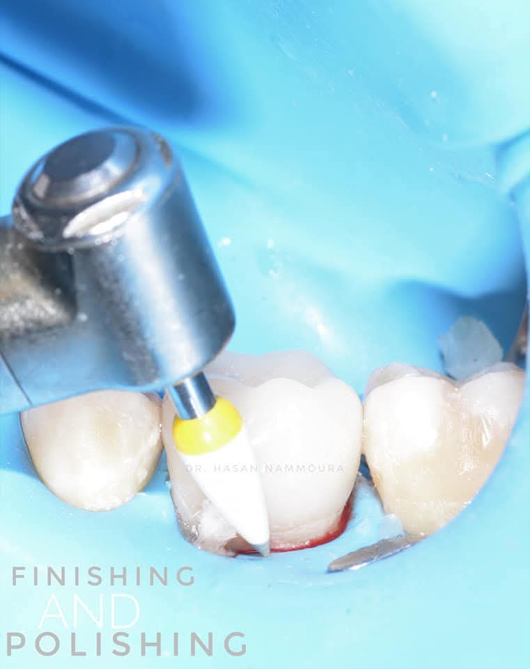 inbound1792943326232162041