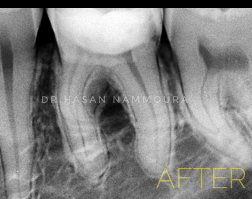 inbound3263212473453353351