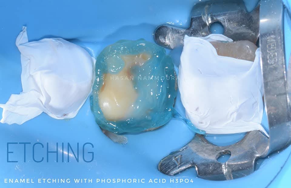 inbound347615532655331058