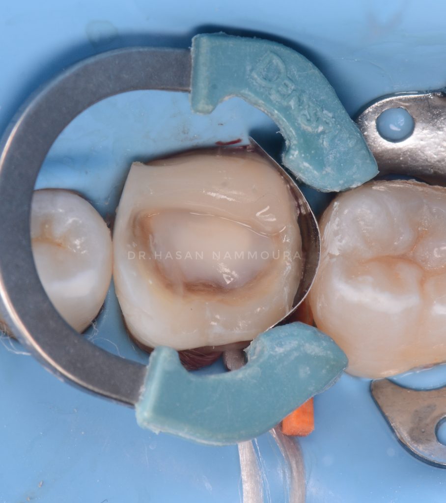 inbound3557499762074200376