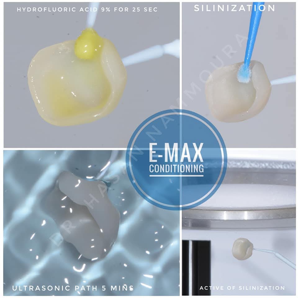 inbound3589156637639093622