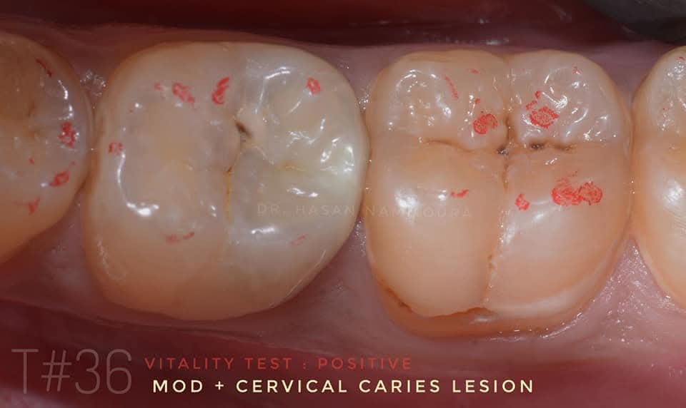 inbound4847026610741225164