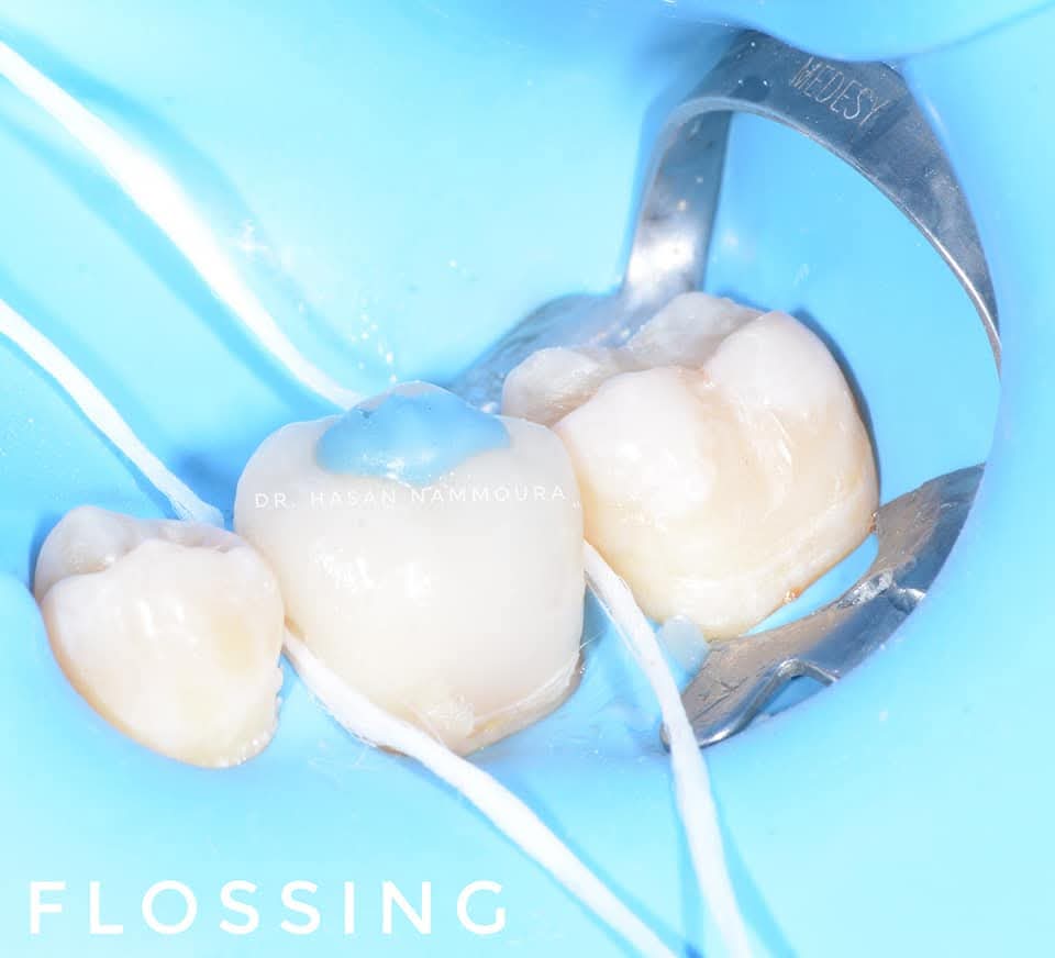 inbound4924360993750799142