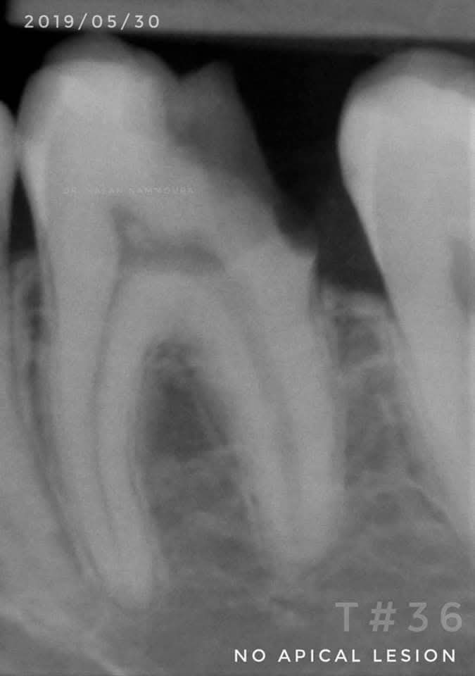 inbound5384775465622145658