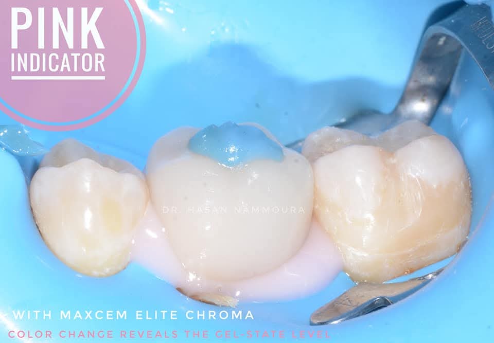 inbound5879518528356356206