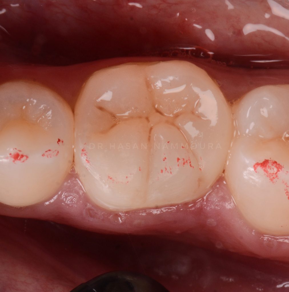 inbound6237428713151664820