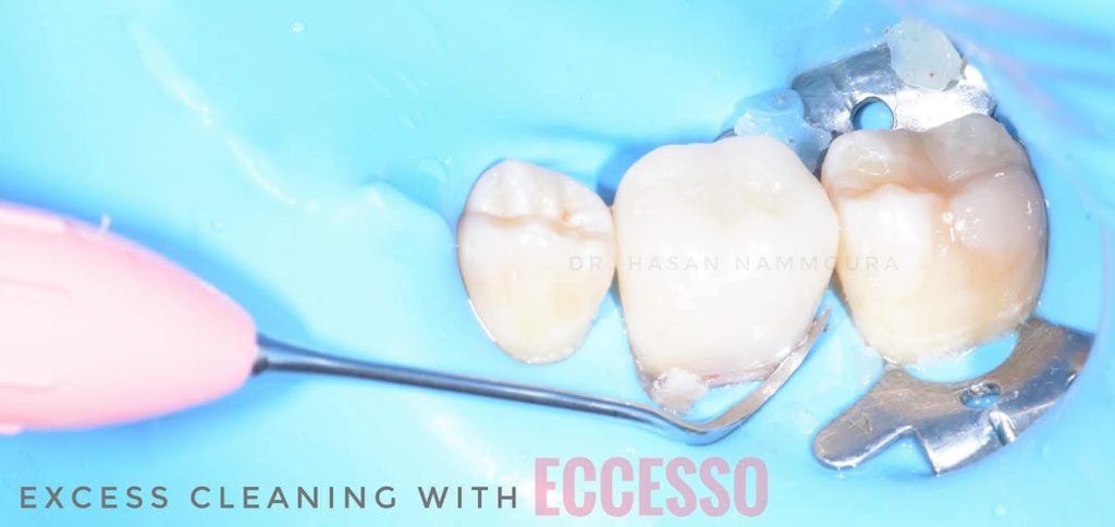 inbound6239491334576520037