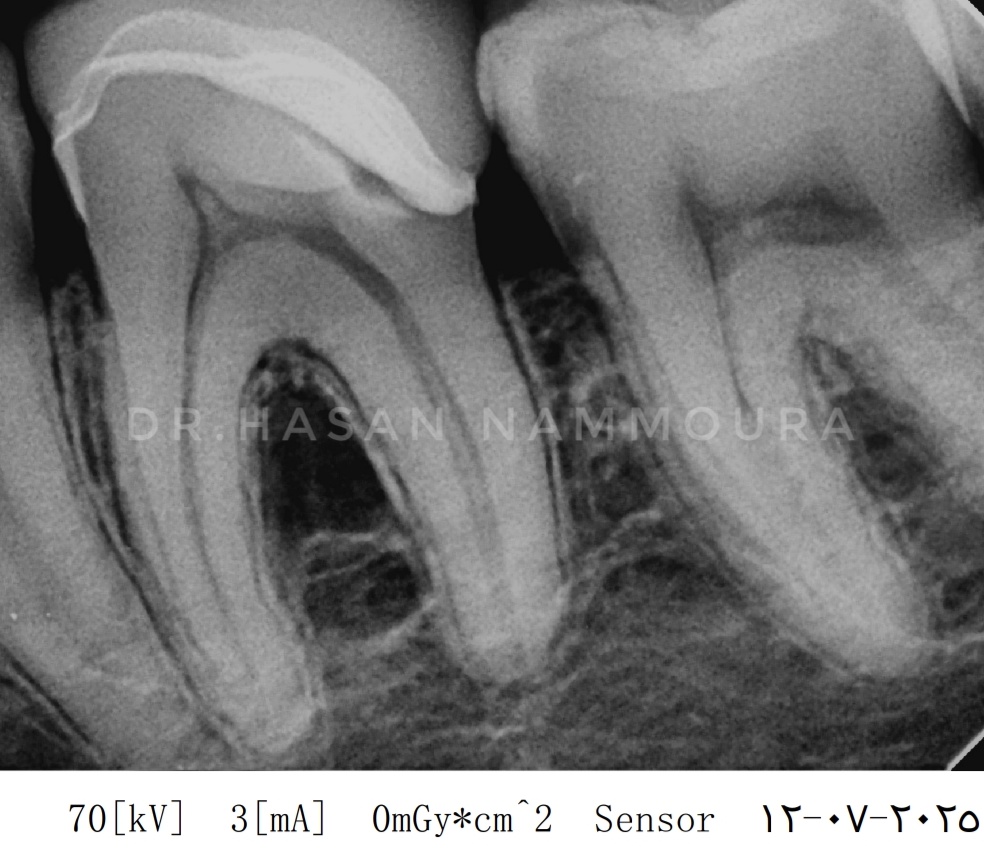 inbound6456472295706536746