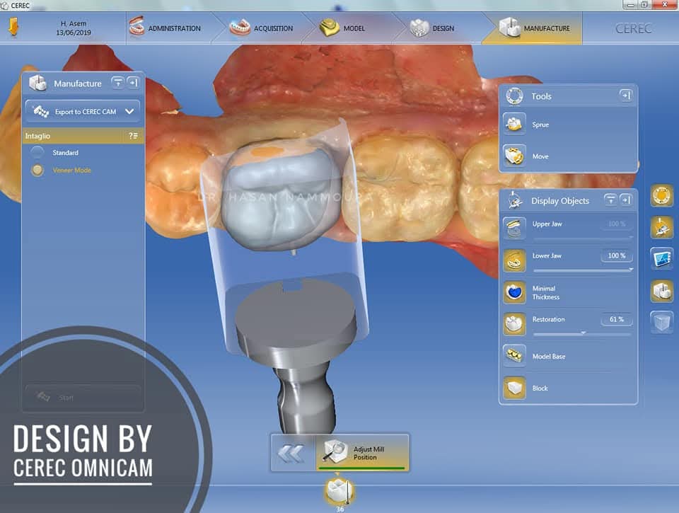 inbound6932349762130895970