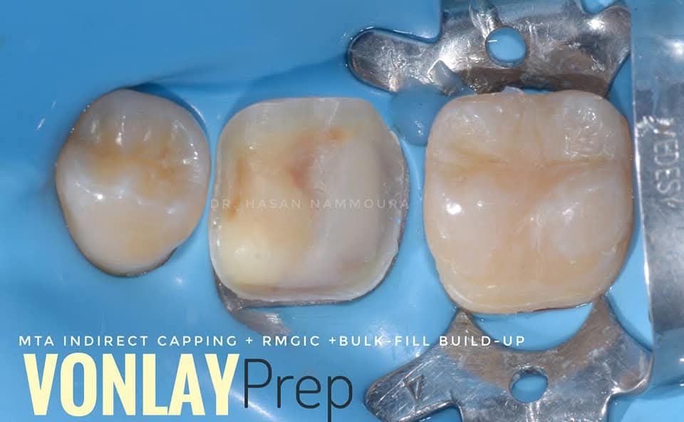 inbound6961949373805057989