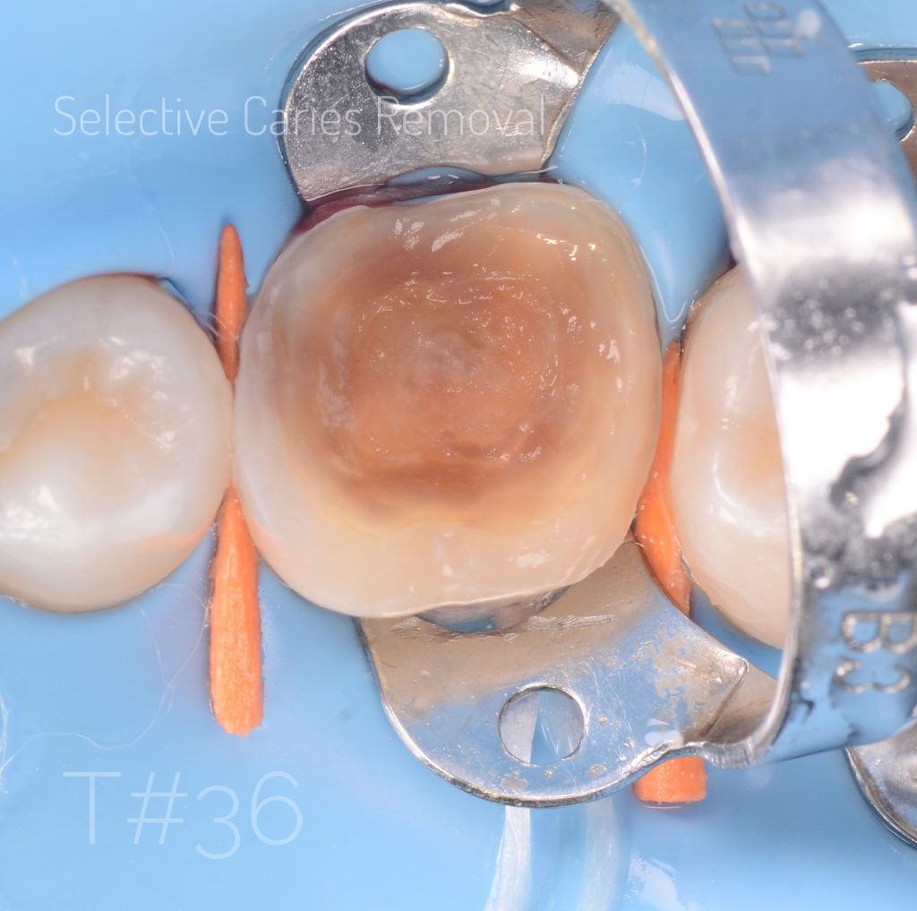 inbound7335934540281128451