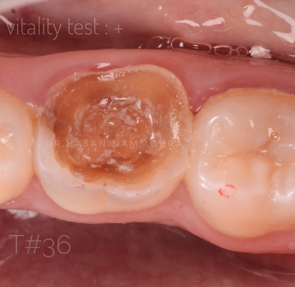 inbound8110623793304852369