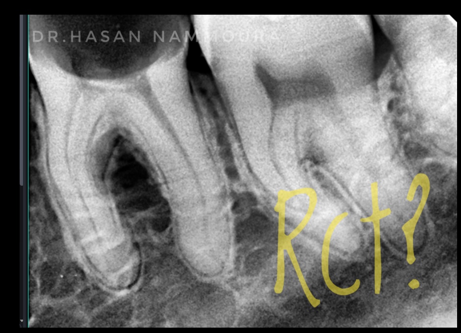 inbound9187365406359785356