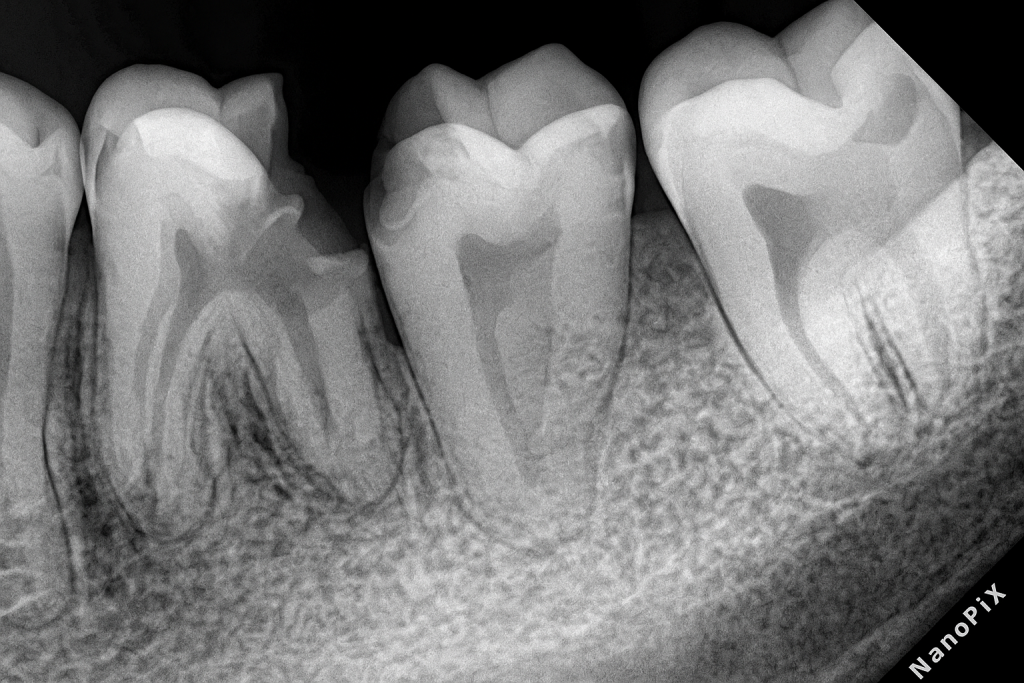 1763A066-C98A-46F7-9799-8A8747D3563D