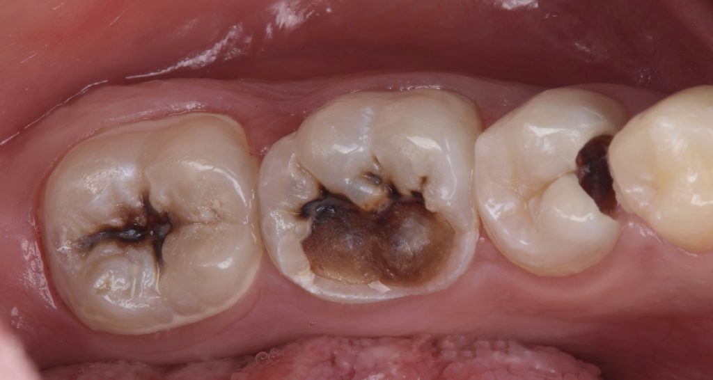 1A1000B9-B0AB-46DA-BAA1-D2F890B9604E