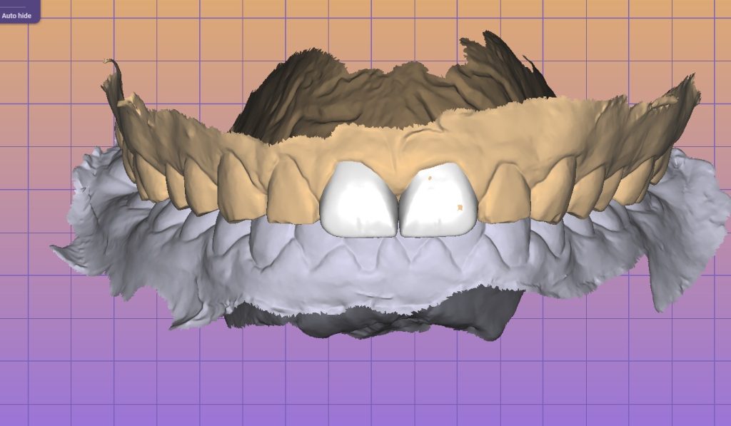 1b0f28bf-1be3-4a50-8882-7efa8f8ae7e8