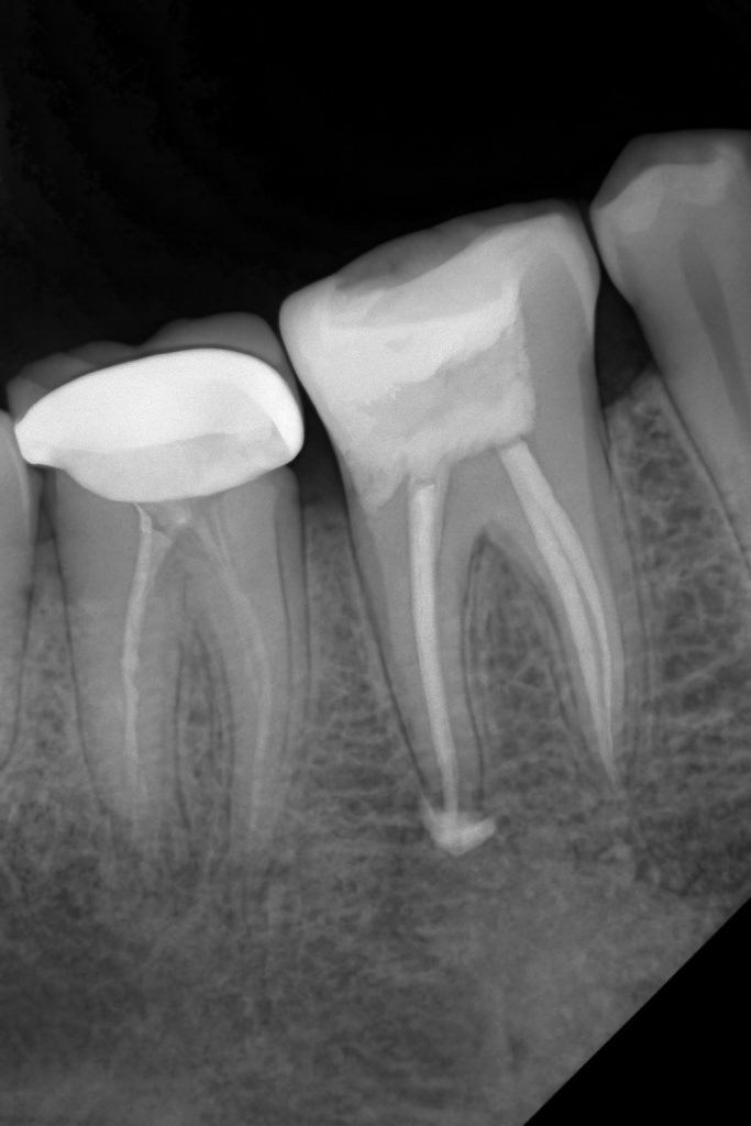 2361F524-47A9-49DD-A305-80C4D7B8CDA3