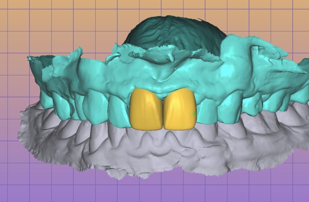 6d66d63a-7789-488c-8fa3-c75227affd86