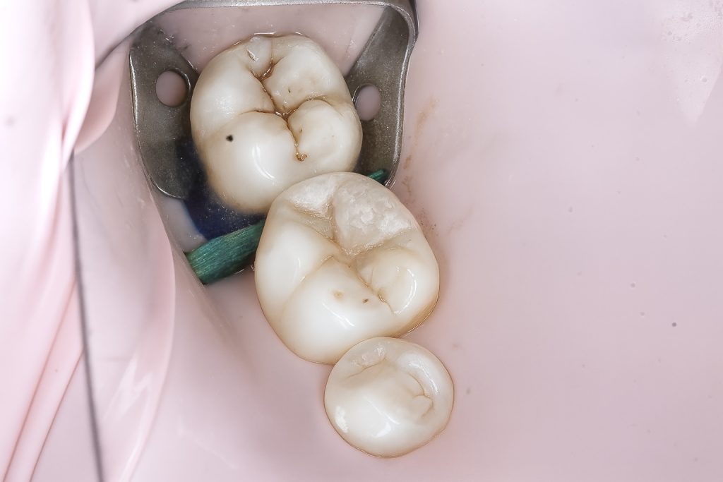 73166F9C-7F9A-416A-B8E3-8A584DE50F90