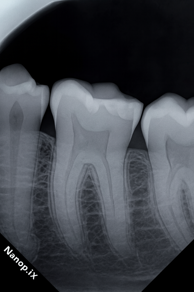 75E8CE50-8CB6-4842-AF9B-0EB5D99B06B8