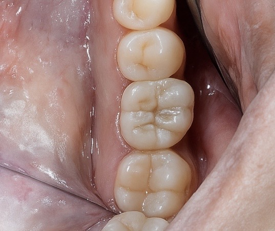 85D500D2-4264-4DB9-9A24-FF7B02D25956