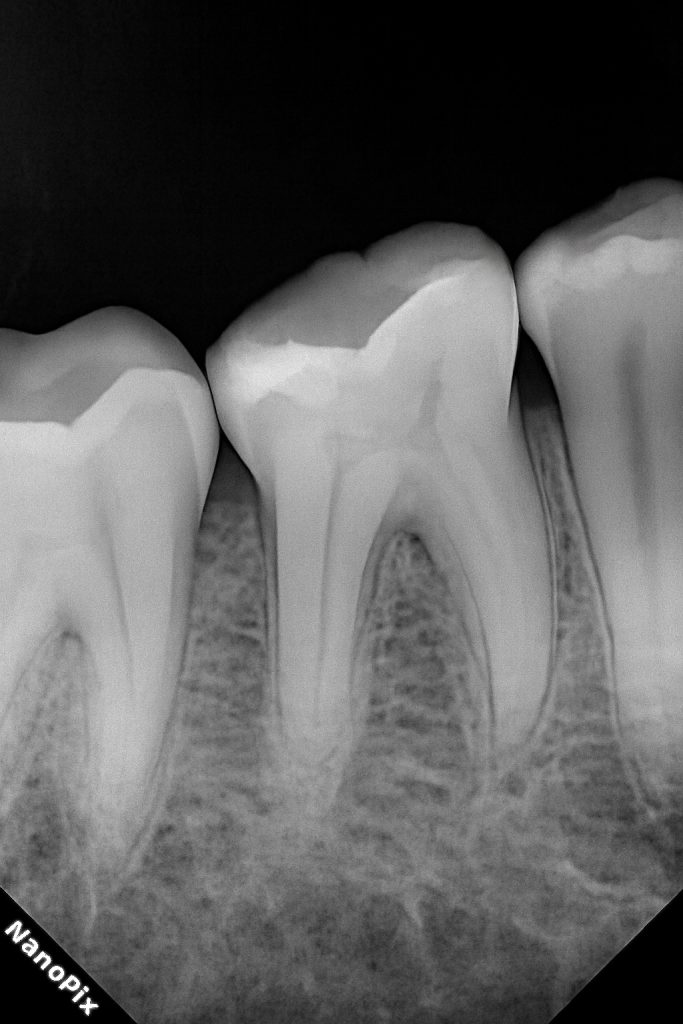 9CEA6C0D-ECDD-4EC5-A9B0-25647C3AE066