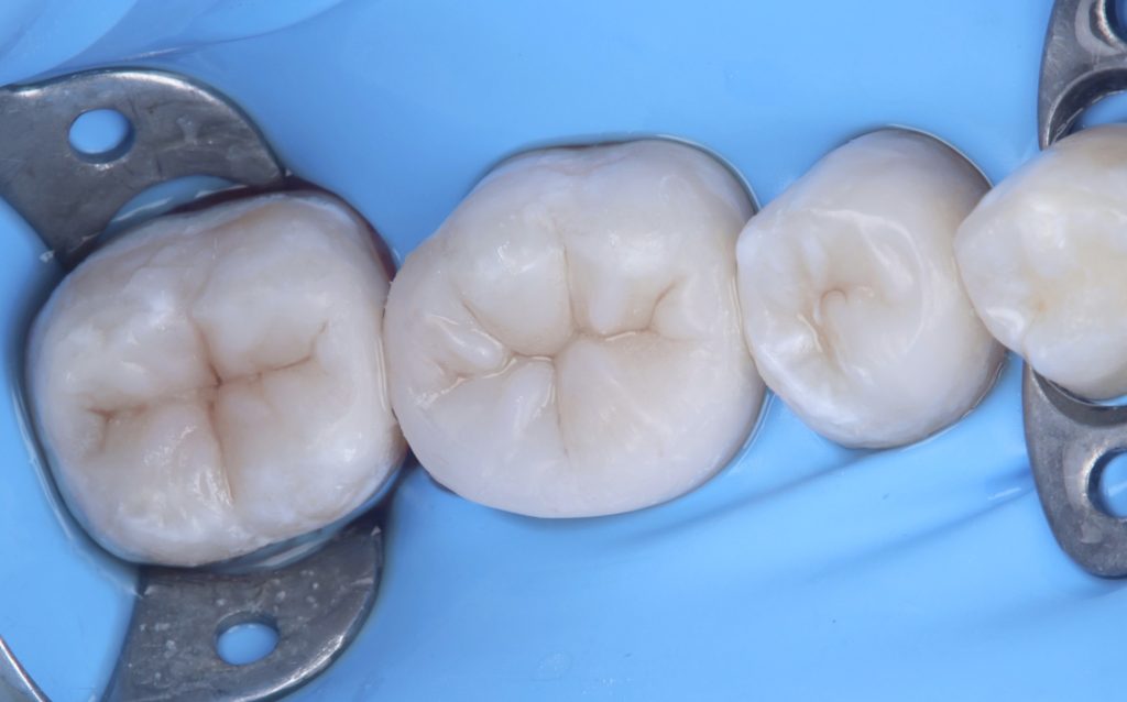 BCE1FE31-8ED1-4397-9B8E-E45EC1FDD4F3