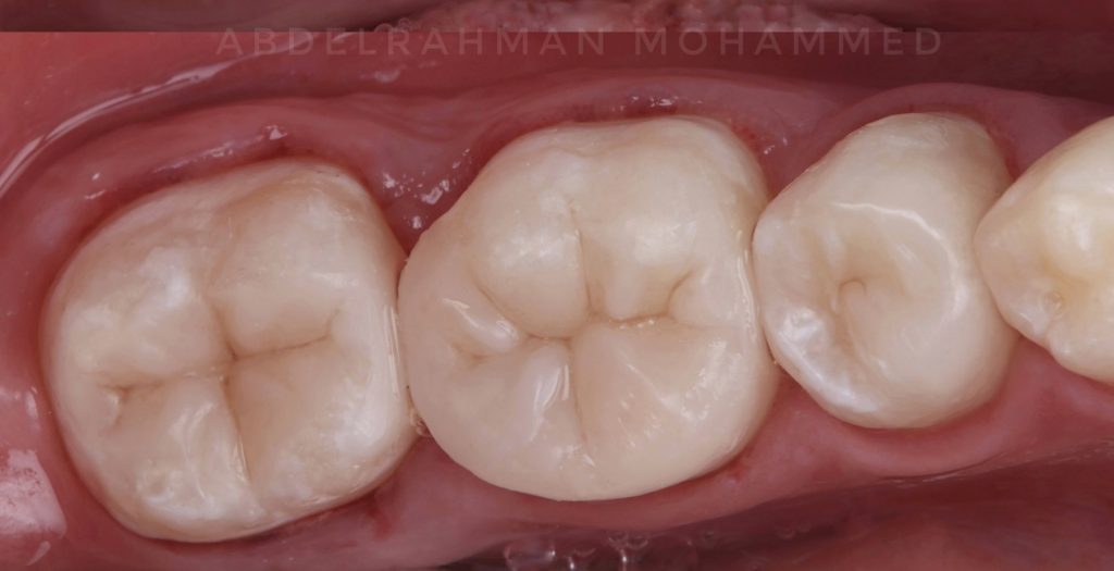 DD48E515-3959-47EA-B6A0-66CA19522507