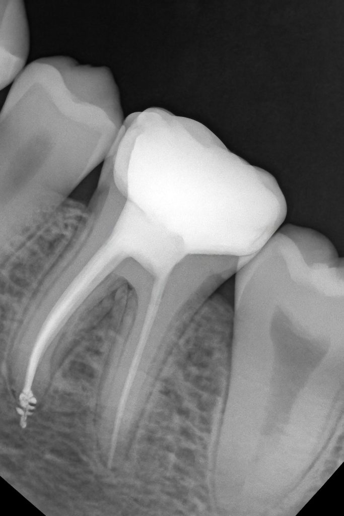 F03C5270-0A9A-44D3-BFD9-6AAA7B0D80EC