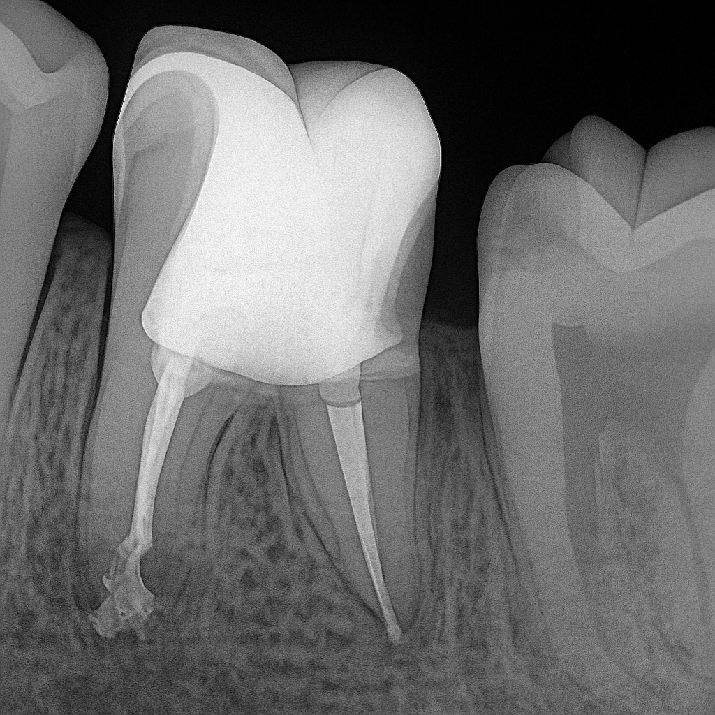 F2D04C69-4C4E-4437-A94F-DDE3F0D44656