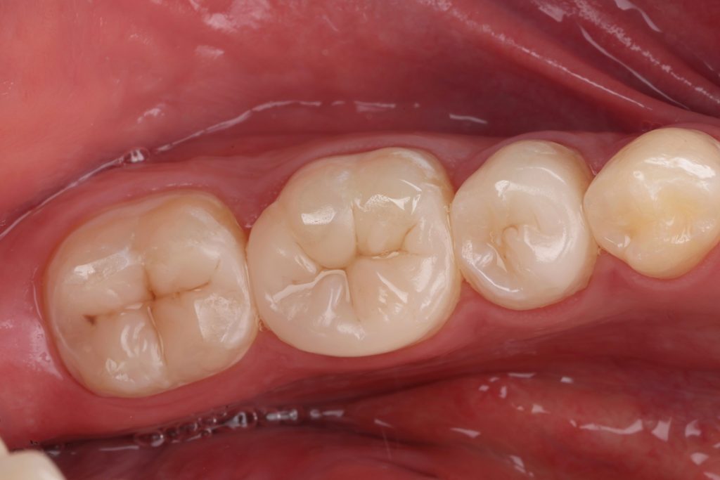 FB7F6B1A-7DE6-4A48-A32D-43C0E1EDAE22