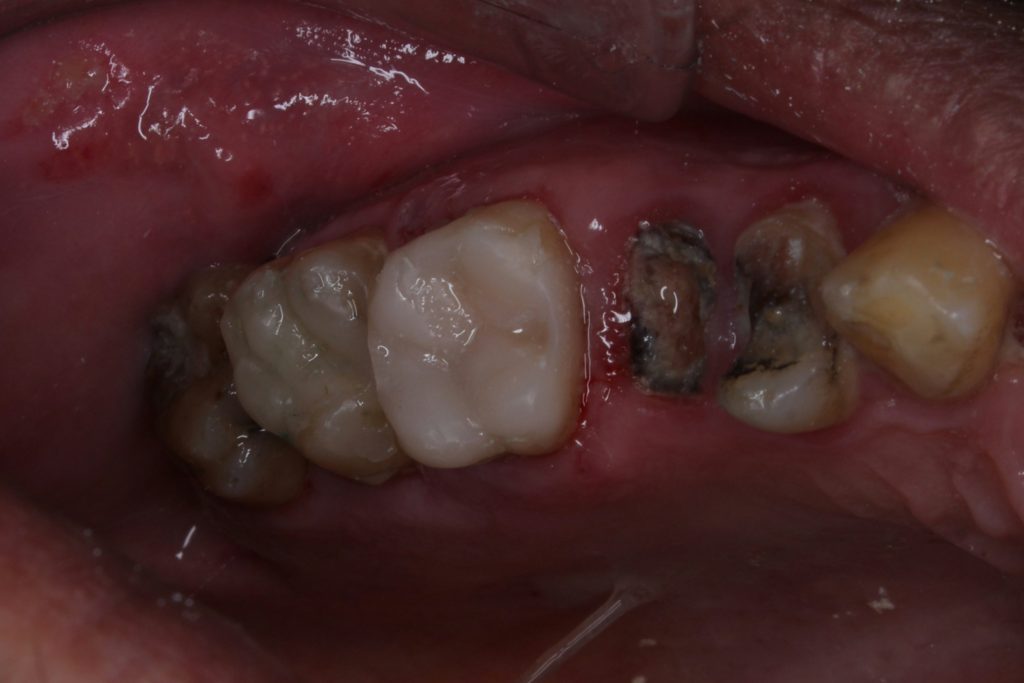 inbound3420590765775120612