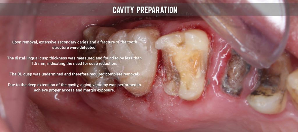 inbound3792334865293849739