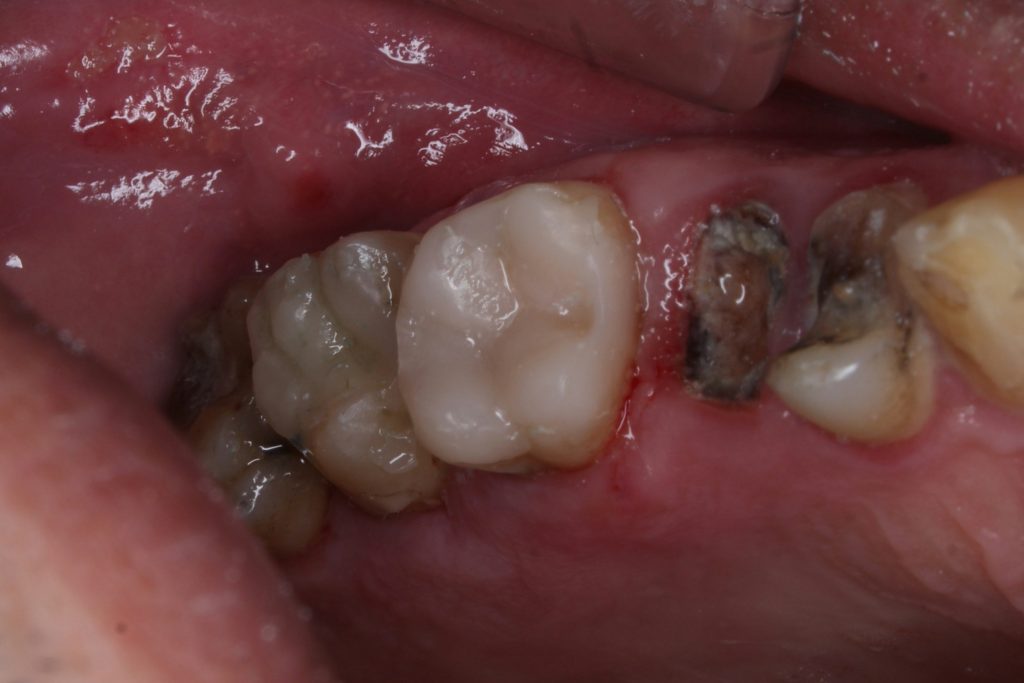 inbound5185957270687527248