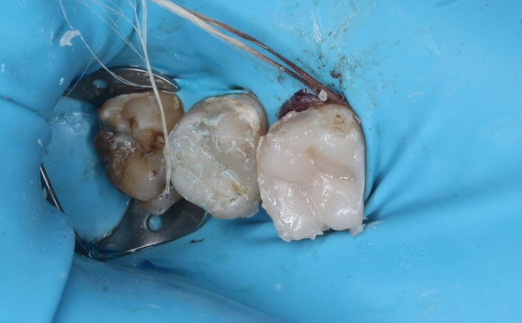 inbound5908633481154289864