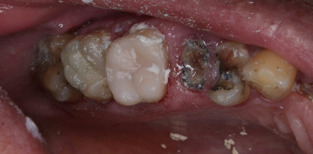 inbound7064275207355158569