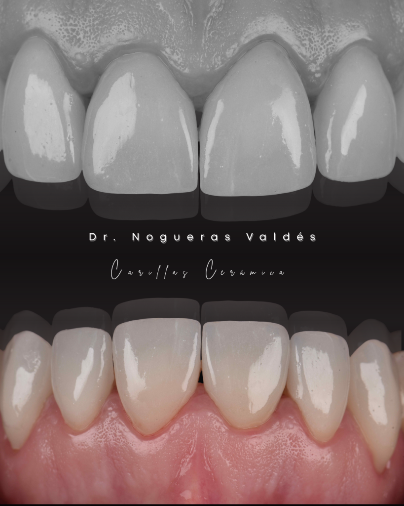 Dr. Nogueras Valdés - 1