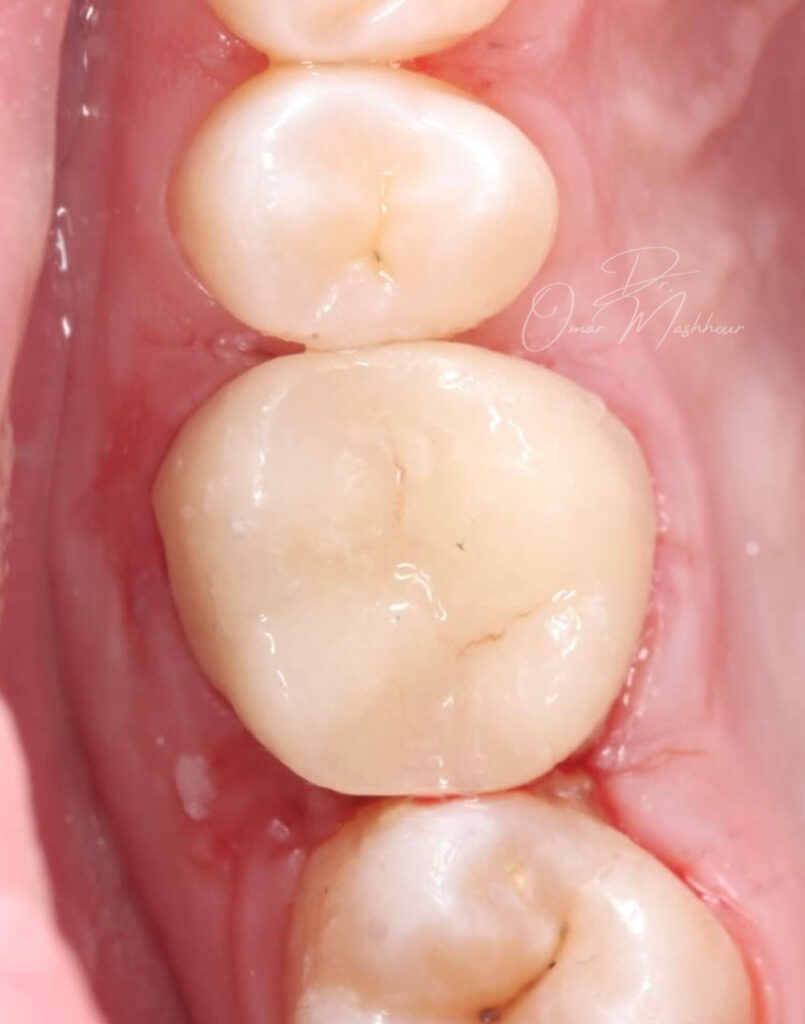 06154F68-F146-4777-9E91-A1FE6D2C6B8A