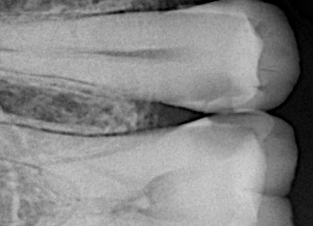 2C43EF3D-87BD-43D1-B023-C2F34FACA4B3