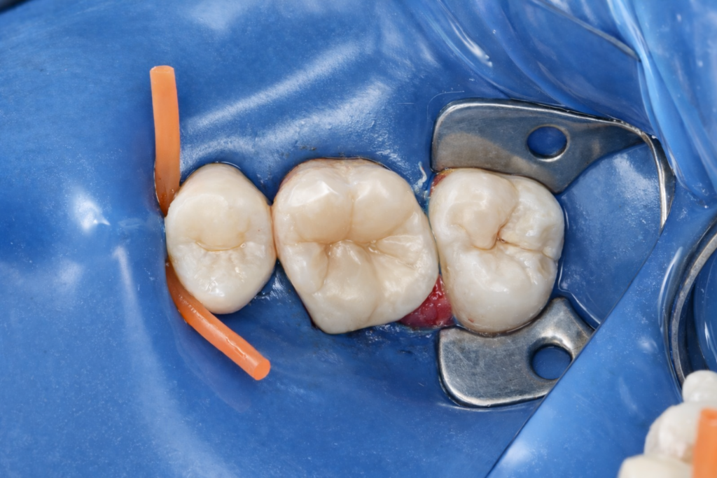 39A5CCE0-CB86-42D9-8FAD-B66DFB815A87