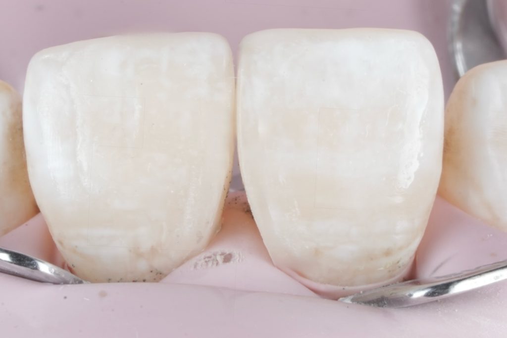 53C30630-2093-4778-90E5-358BCB2D6933