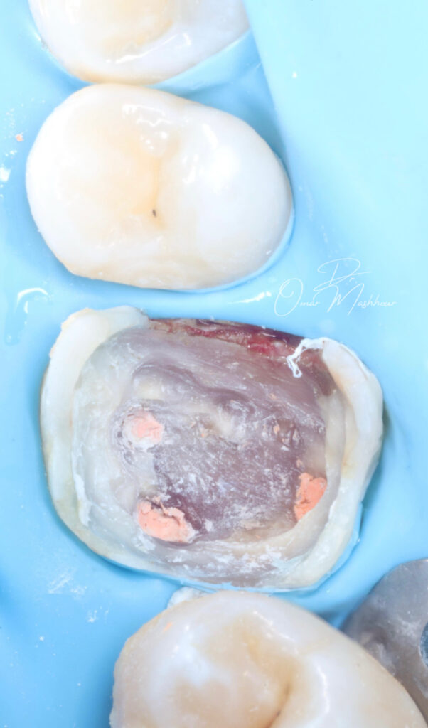 64A231FA-9128-4F8D-B337-A6773ADFF4C1