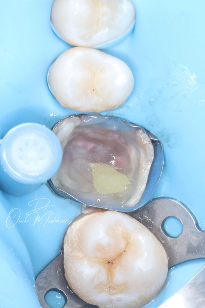 6E0698A3-1C28-47E4-8881-A87E3B3B8568