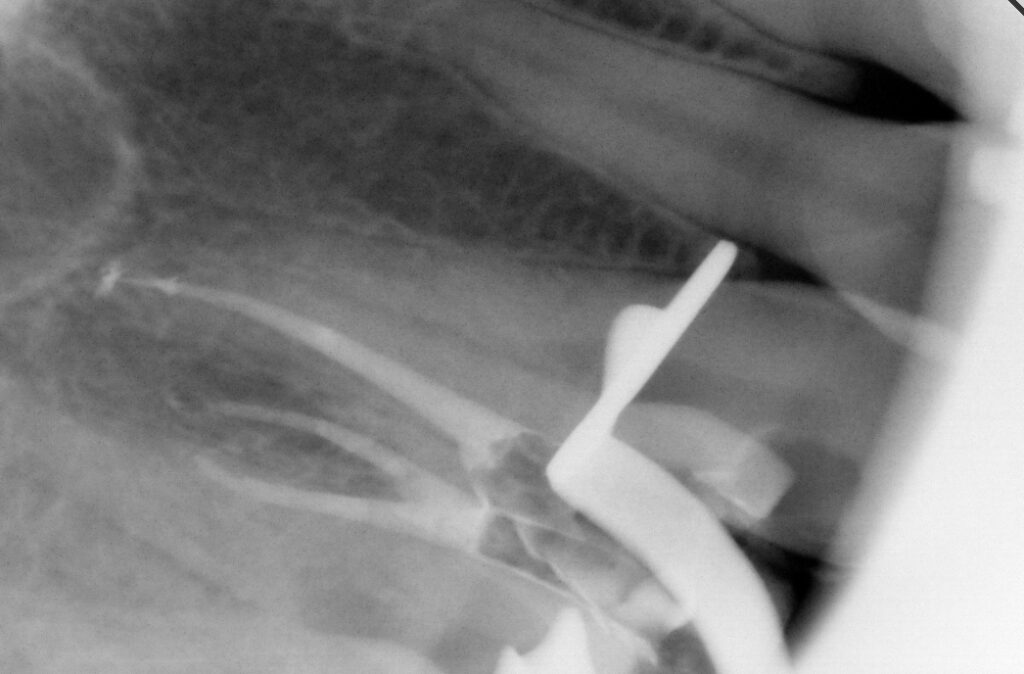 Bazaart_3B683725-5B57-4C50-A96E-12645EE2A52F