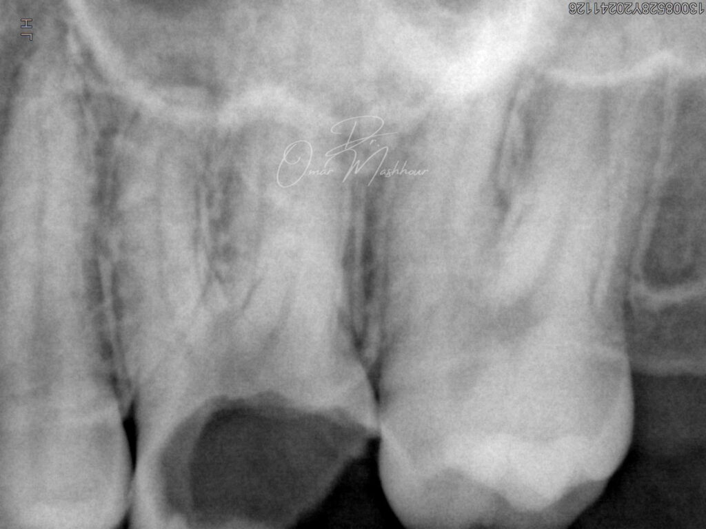 CCAA0416-67BB-493B-BA05-67D3347F9882