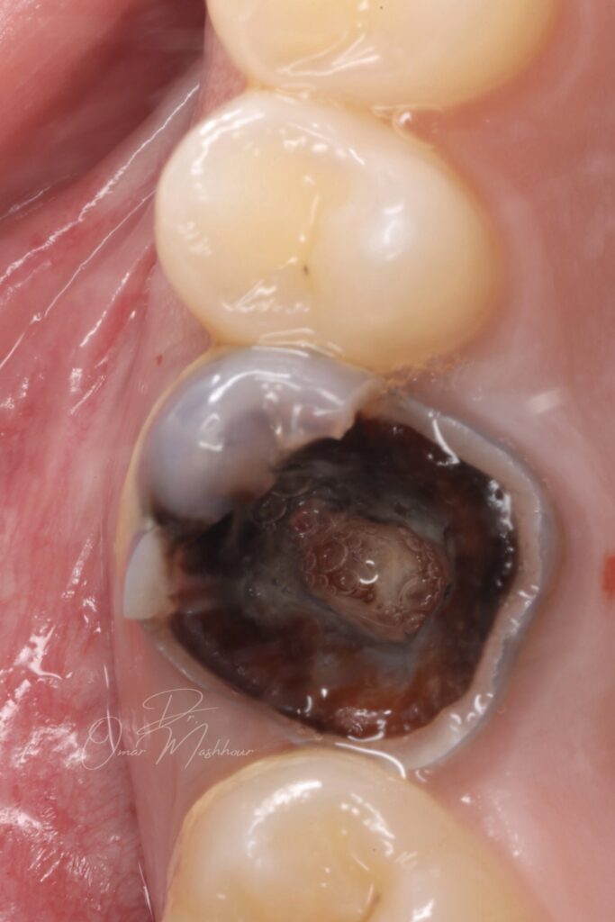 CDE3ED77-E56D-4471-A4C8-ABF2310DA95C