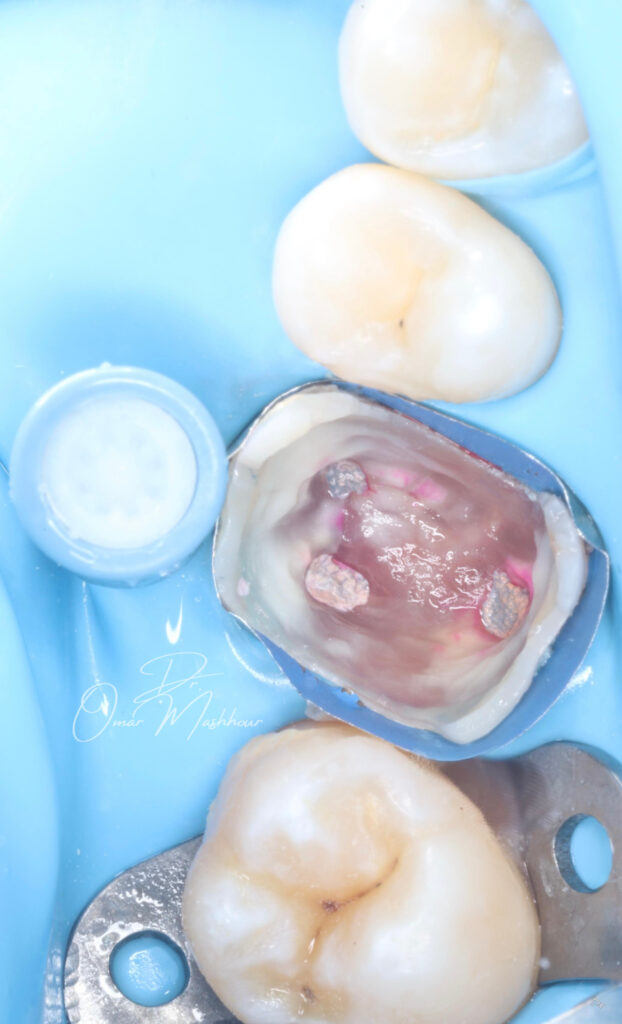 D16DBE13-EDF0-45CB-AA63-CA6EFD3BF39C