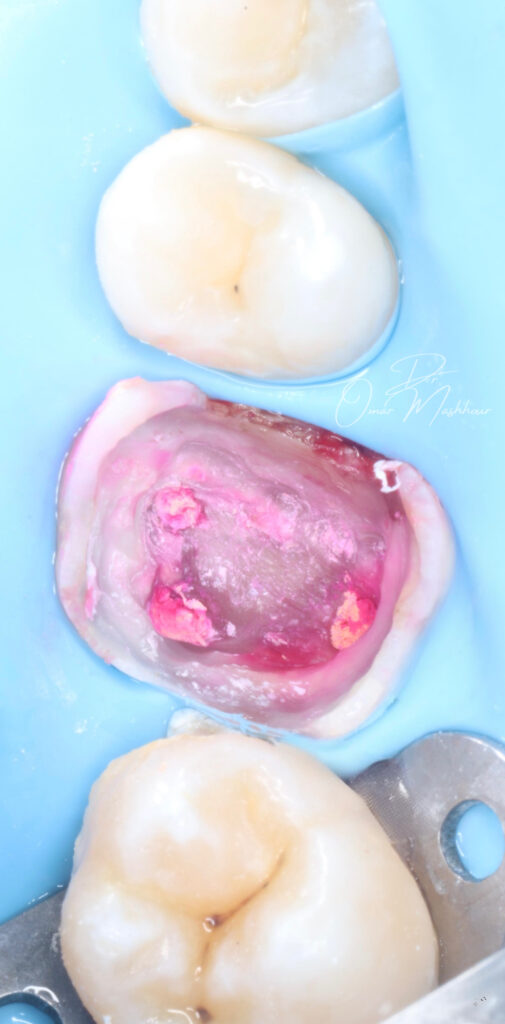 FDBCA26D-EEAD-4D3C-8BD3-2AE13A14DEE6