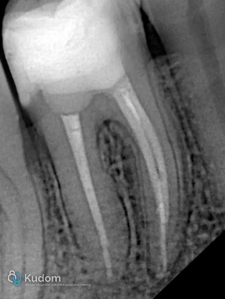 54FF39EC-CF0E-49D0-8769-519635CEEFAC